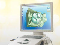 Cerec 3D