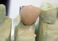 Krone auf Gipsmodell