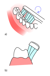 Grafische Darstellung der Putztechnik